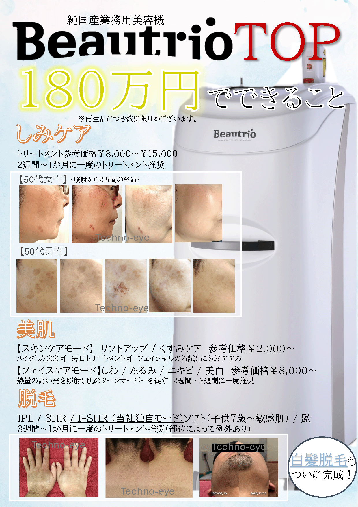 純国産業務用脱毛機 Beautrio TOP 180万円でできること